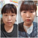 바디슬림 이미지