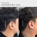 마음에점을찍다두피SMP 이미지