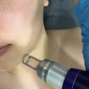 여우만들기 | 기미·모공·잡티 고민 끝! 진천 피부관리 '여우만들기 연구소' 체험후기