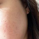 디어뭉치 | 디어글램 753 시카 SOS 카밍 베리어 크림 - 화농성 여드름 피부가 직접 써봤어요