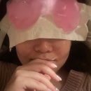 루호성형외과의원 | [쌍수일기]만보걷기/2주차/눈매교정/절개