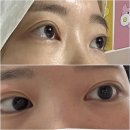 왕십리 속눈썹펌 라보떼래쉬 밋밋한 눈에 포인트! 속눈썹 펌+포인트래쉬 후기