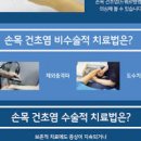 손목건초염 효능 및 증상 드퀘르벵 이미지