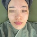 기미 주근깨 색소침착 고민, 새솔동 피부관리 더샵끌림에서 화이트토닝으로 해결하세요