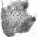 [신비십자손금 사례1] 이미지
