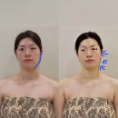 론디뷰티 | [강원/춘천] 춘천 윤곽관리, 얼굴조각관리, 바디관리, 웨딩관리의 진수 "론디뷰티"