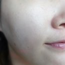 진선미피부 이미지