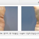 미큐의원 네이버블로그