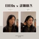 쿨 | ️땅콩형 얼굴 중안부 줄이기 🥜 얼굴 맞춤 디자인 상담 + 티타늄 &amp; 쿨페이즈 후기