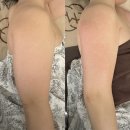 디자인올다 - 성북구 도봉로3길 21 | 다산피부관리 미올뷰티 - 티리온X 올다리프팅 팔뚝 슬리밍 관리 후기!
