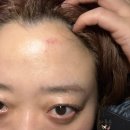 라브르경락 | 세종 경락 라브르필라테스 세종점x가인명가 윤곽관리 후기_윤곽받고 에뻐지자