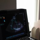 건강초음파 이미지