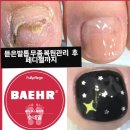 베어수