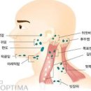 왼쪽 오른쪽 귀뒤 통증 멍울 원인 이미지