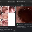 조영상사 | [난임시술] 임신 시도 1년 반의 기록