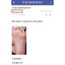 보고 발관리
