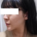 투턱 이미지