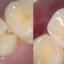 이바른치과기공소 이미지