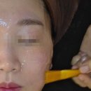 메디컬애비뉴 | 가경동 피부관리 스킨힐로우에스테틱 진정재생관리 받고 피부 컨디션 되찾은 후기