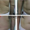 금불테라피 이미지