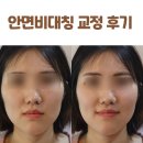 강남경희한의원 | 안면비대칭 교정 후기 강남논현 심용섭십장생한의원