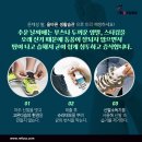 나도손톱 레푸스 개봉점 네이버블로그