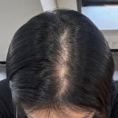 브로우기프트 | [웨딩준비] 압구정smp 브로우기프트 두피 커버 후기