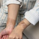 왕지약국 | [ 31w-32w ] 임신 31주 혈액순환장애, 한의원, 산전마사지, 임신 32주 정기검진, 제왕절개 결정, 백일해...