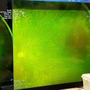 마이오서울안과의원 | 인천 송도 안과 눈질환전문 마이오서울안과 검진후기