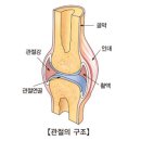 점액낭염[Bursitis]근골격질환 이미지