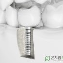 곤지암포레치과의원 이미지