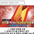 참쉬운다이어트 이미지