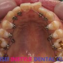 CORE 치과기공소 이미지