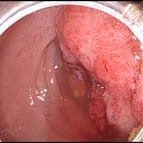 장새로내과의원 이미지