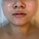 [진접 포천피부관리] 얼굴 라인관리 후기 오늘도 맑음 방문