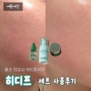 휴림소프트 | [내돈내산] 히디프 | 버블토너,세럼,크림 세트 인스타 광고템 민감성 홍조 여드름피부 사용 솔직후기