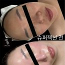 황금마법사청소독 | [포항 피부관리] 포항 모공관리 홍조 관리까지 한 번에 잡는 포항 슈퍼젝션전문점 "에끌라 뷰티" 리얼 후기