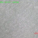 STS316 조직사진 이미지