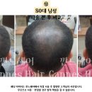 깐느헤어 이미지