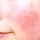 눈꽃피부과의원 이미지