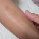 [육아] 아기 아토피 진정 아토햄프크림 유아 신생아 로션 — 카나비노이드 성분 케어 후기