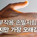 항암치료 부작용 손발저림 말초신경증병, 초기 대응이 중요합니다 이미지