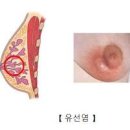 여성 유두 통증 원인과 치료법 유두가 아파요(생리전 모유수유 임신) 이미지