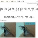 MGF두피탈모센타