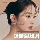 고움의원 | 이물질제거 후기, 불법 성형시술 부작용 바로 치료하셔야 합니다