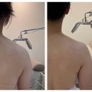 비디알(bdr)