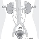 남성암, 전립선암 증가율 높아 이미지