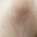 에이엔에이빌딩 | 분당 서현 알레르기 전문내과 A&amp;A내과