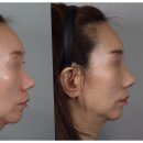 비트윈성형외과의원 이미지