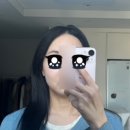 톡투필라테스 | 신사피부과 | 30대 첫 리프팅 울쎄라 300샷 내돈내산 후기(마취, 주의사항 등)